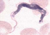 Tripanossoma: exemplo de protozoário flagelado
