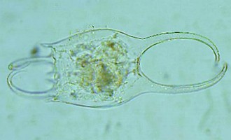 Brachionus falcatusa zacharias Imagem microscópica do Brachionus_falcatus_zacharias