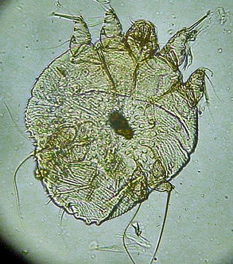 imagem ampliada de um &aacute;caro-da-sarna