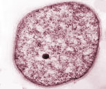 Sulfolobus sp.: exemplo de arqueobactéria