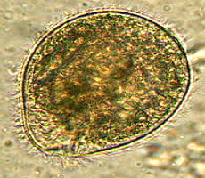 Balantidium coli, imagem ampliada em microscópio