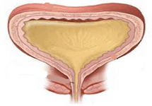 Bexiga urinária cheia de urina