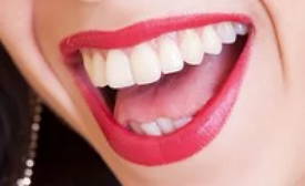 Boca humana aberta mostrando os dentes