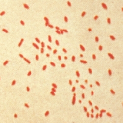 Imagem de microscópio de uma colônia de Bordetella pertussis