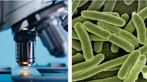 Imagem de microscópio e bactérias e.Coli