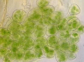 Células vegetais ampliadas em microscópio