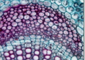 Esclerênquima: tecido vegetal de sustentação (imagem ampliada)