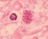 toxoplasma gondii: esporozoário causador da toxoplasmose