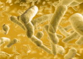 Eubactérias: muitas são causadoras de doenças
