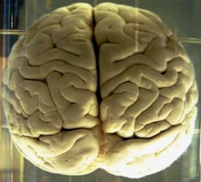 Foto de um cérebro humano