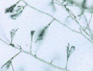Hifas de Penicillium Imagem de microscópio de hifas de Penicillium