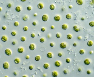 Imagem de microscópio mostrando microalgas