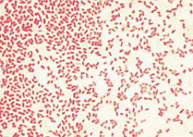 Imagem de microscópio da bactéria Pseudomonas aeruginosa