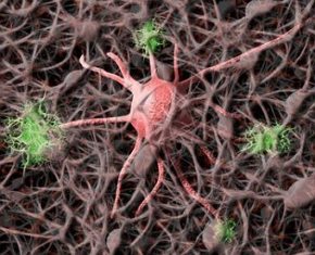 Modelo de uma célula nervosa, neurônio.