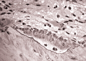 Osteoblastos atuando na produção da matriz óssea