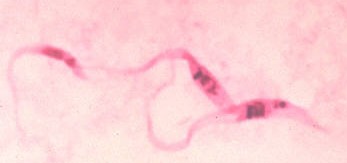 Trypanosoma cruzi