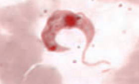 Trypanosoma cruzi, imagem de microscópio