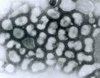 Vírus Influenza (causador da gripe): imagem de microscópio