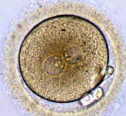Imagem de microscópio de um zigoto humano